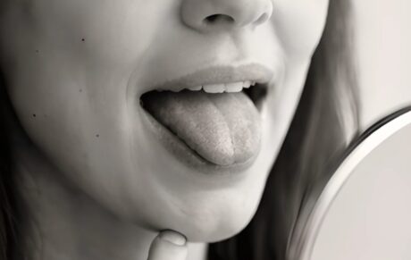 En indre-motorisk tilgang til dysartri